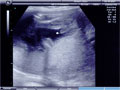 baby3.jpg