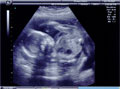 baby5.jpg